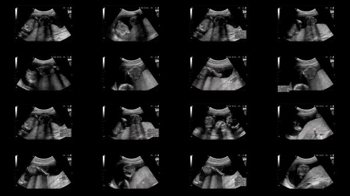 超声检查孕妇肚子月子中心胎教母婴孕育怀孕