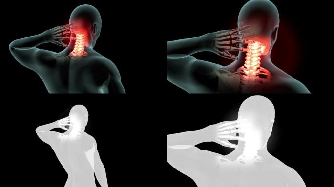 颈痛医学人体骨骼三维动画腰椎脊柱动画