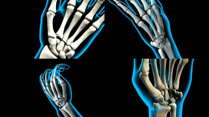 人手的X线研究手骨手掌透视