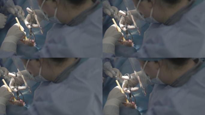 种植牙手术医生做手术Clog3佳能50帧