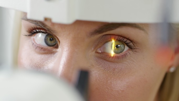 用裂隙灯检查视力眼科医生诊所晶状体眼