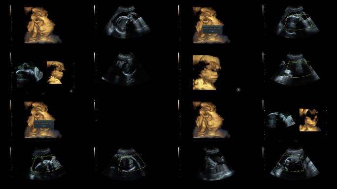 超声检查孕妇肚子月子中心胎教母婴孕育怀孕