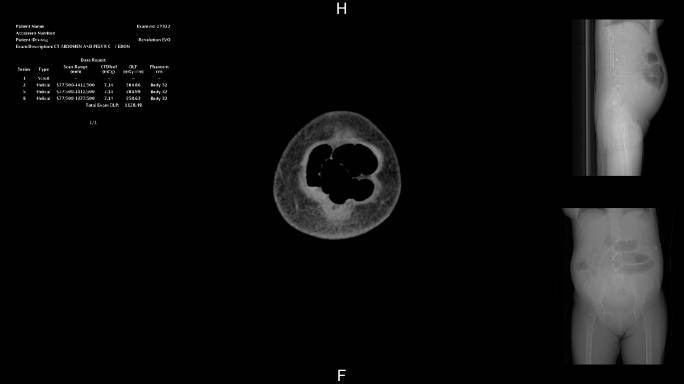 断层扫描人体透视黑白