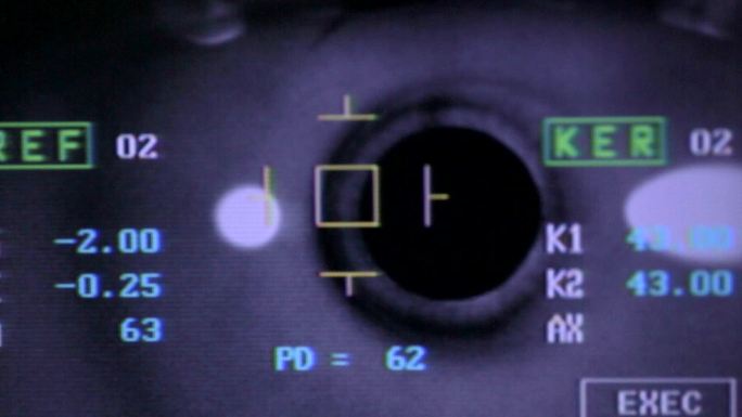现代自动眼球检查机。