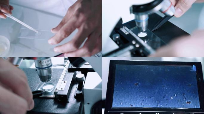 研磨粉末显微镜检测酵母