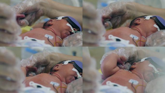 婴儿刚出生的婴儿检查护理