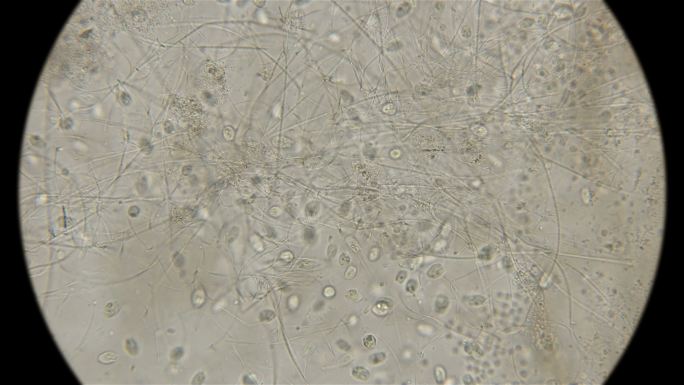显微镜下一滴含有大量细菌和微生物的脏水