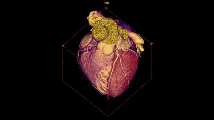 心脏三维图x光检测人生物结构局部观察