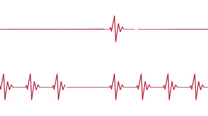 心跳线。心脏脉搏跳动节奏图动画。