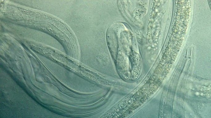 秀丽隐杆线虫显微镜下视频放大细菌宠物