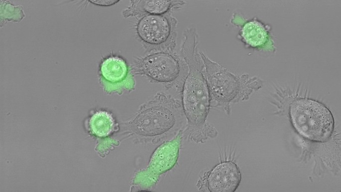培养的PC-3人前列腺癌细胞。