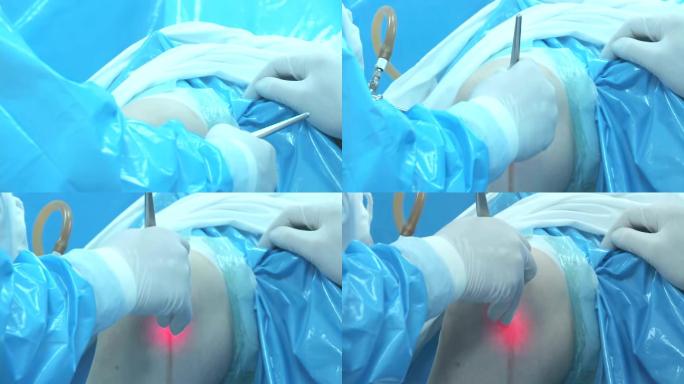 膝盖手术广告医院宣传片视频素材