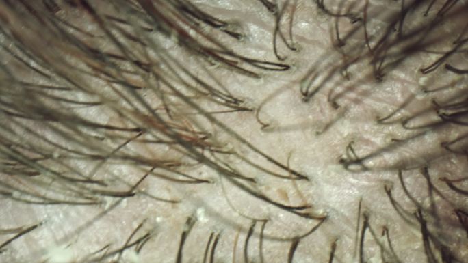 人类头发和头皮的极端特写显微视图