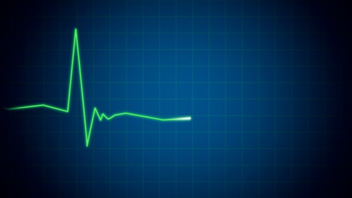 心电图心脏监护仪波动跳动心率死亡