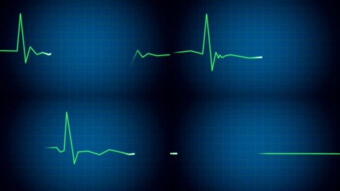 心电图心脏监护仪波动跳动心率死亡