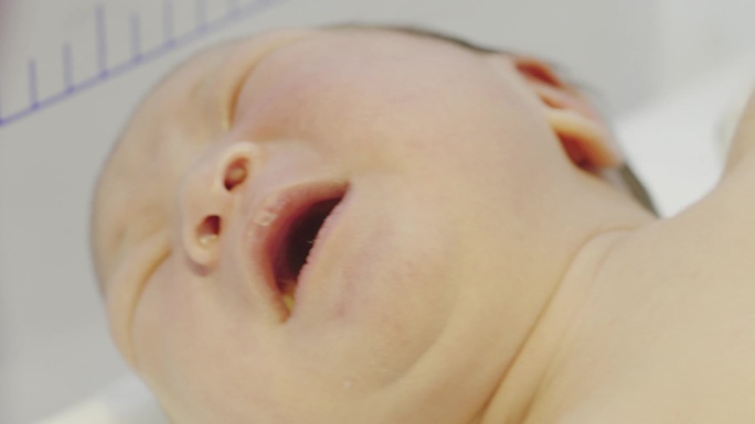 婴儿哭新生儿儿科护理产科妇幼新生儿黄疸高