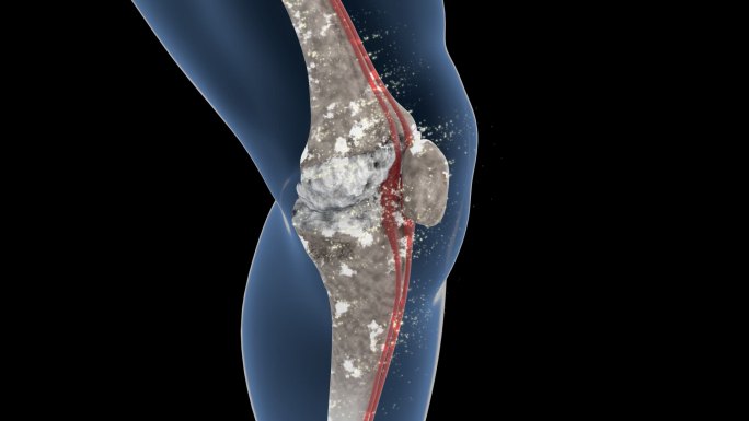 人体机理动画 ——修复膝盖 带透明通道