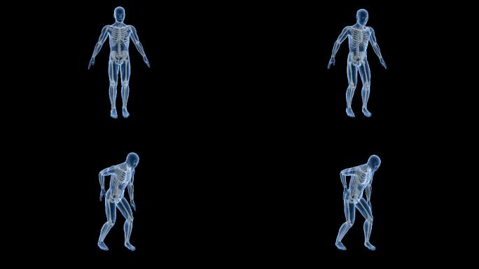 人体机理动画 ——腰疼 带透明通道