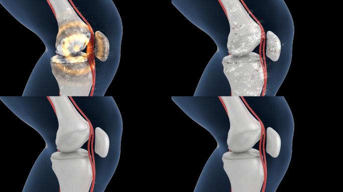 人体机理动画 ——修复膝盖 带透明通道