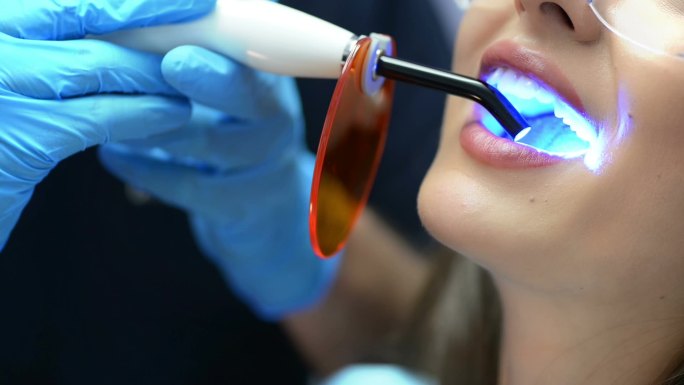 牙医使用紫外线灯美白牙齿