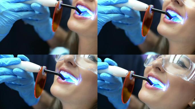 牙医使用紫外线灯美白牙齿