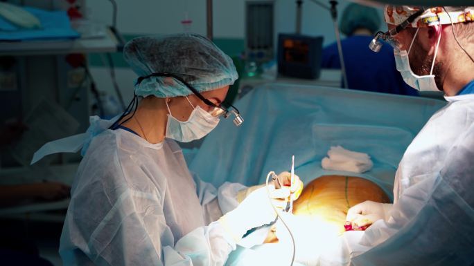 腹部抽脂手术室做手术动手术