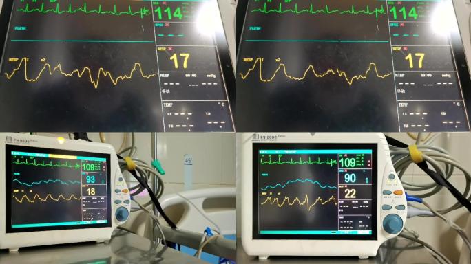 心电图心电监护仪器