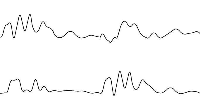 音波、心跳或声波的运动图形绘制。