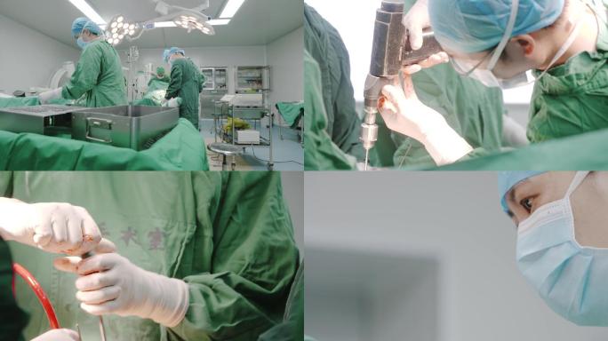大型外科开胸手术电锯开胸手术高级医院