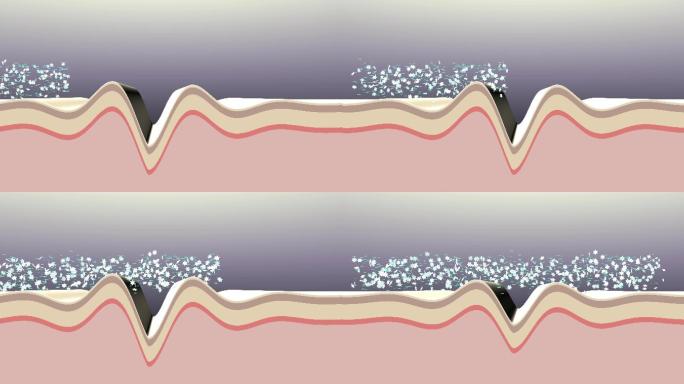 除皱。抗衰老治疗前后的皮肤。3d动画。