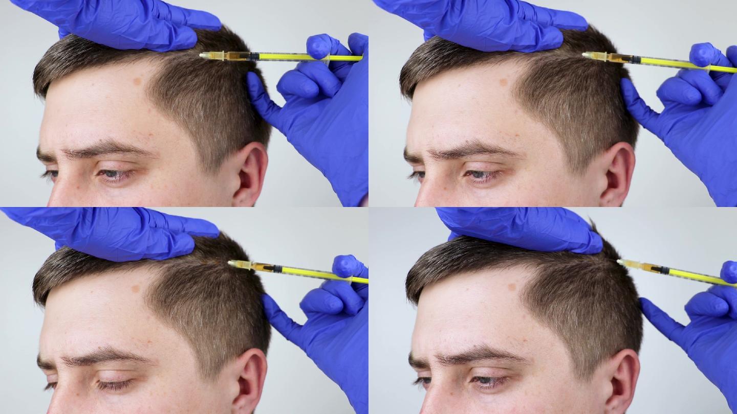 美容师医生在男子头部注射促进头发生长