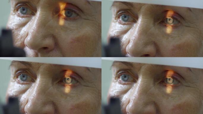 用裂隙灯进行眼部检查的老年女性