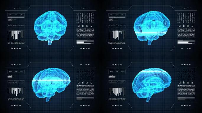 医学抽象动画脑部扫描神经影像诊断技术