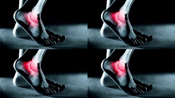 x射线中的人脚踝人体组织器官疾病骨骼
