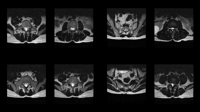 脊柱横截面视图