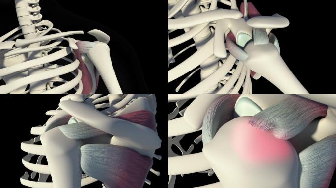 肩袖撕裂外科骨科三维模型3d动画