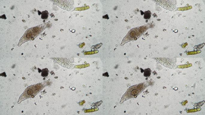 显微镜下的微生物和细菌群