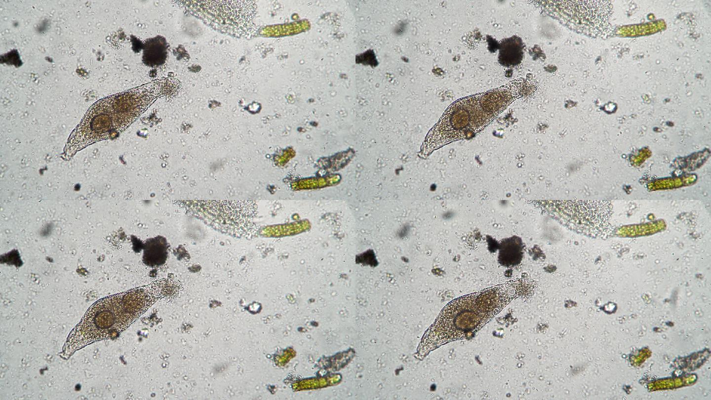 显微镜下的微生物和细菌群