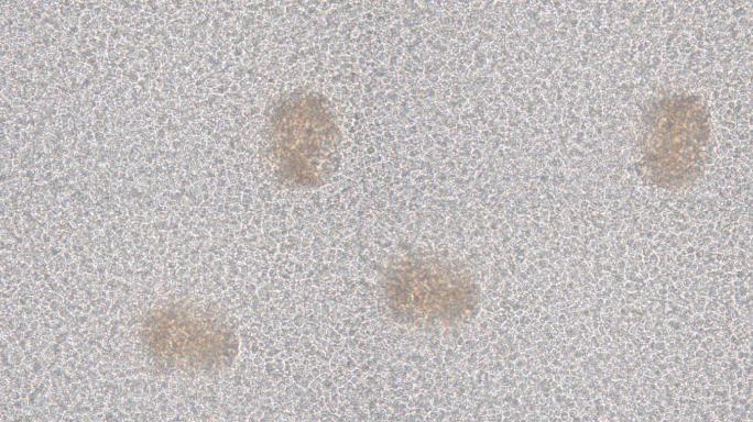 显微镜下的芽胞酵母细胞。