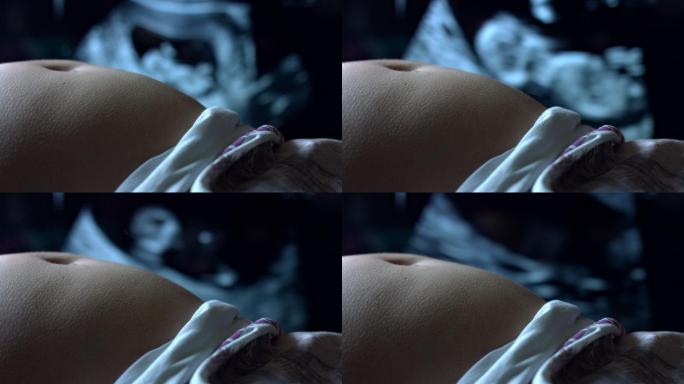 超声检查孕妇腹部大肚子肚皮孕检准妈妈怀孕