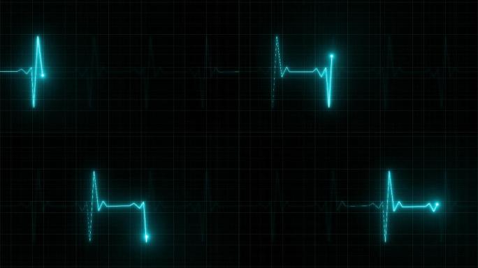 心率监测器心电图心率监控心电波心跳波形