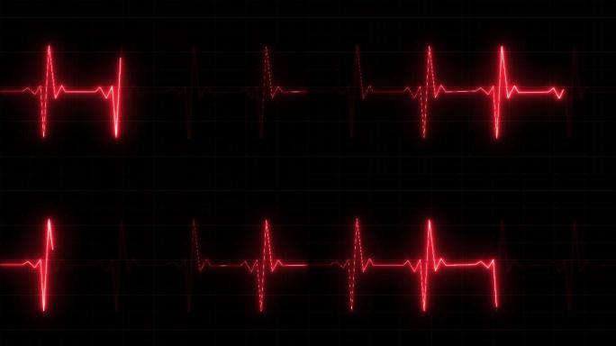 心率监测器心电图脉搏高清视频素材红色