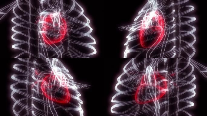 人体胸部心脏的X光检查