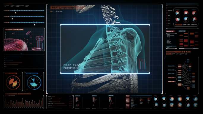 疼痛性关节炎的3D图像