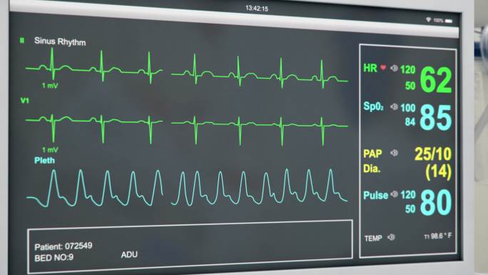 EKG患者心脏监护仪医院设备
