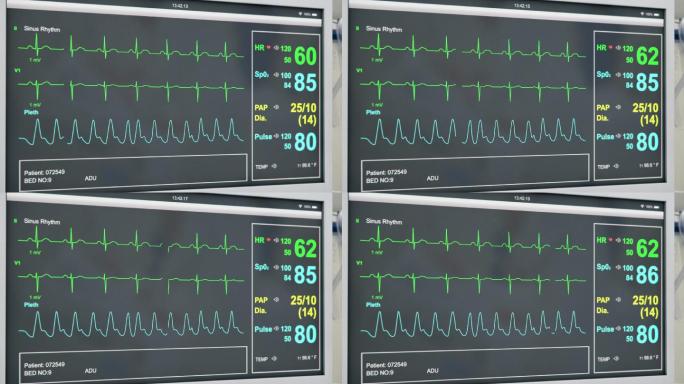 EKG患者心脏监护仪医院设备