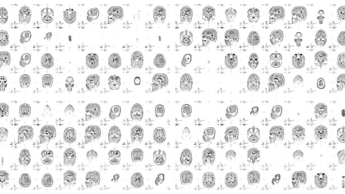 核磁共振成像视频墙