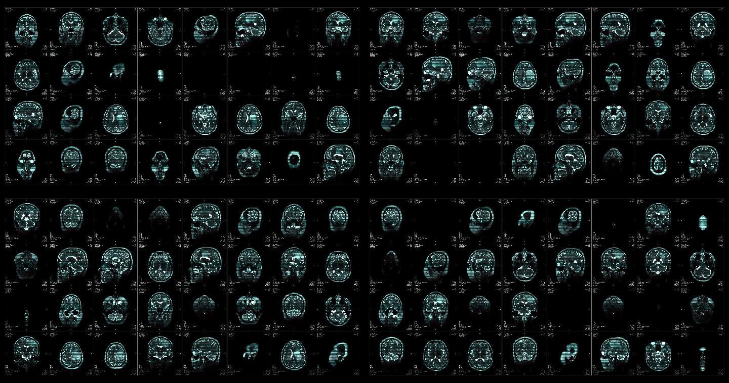 核磁共振成像视频墙。