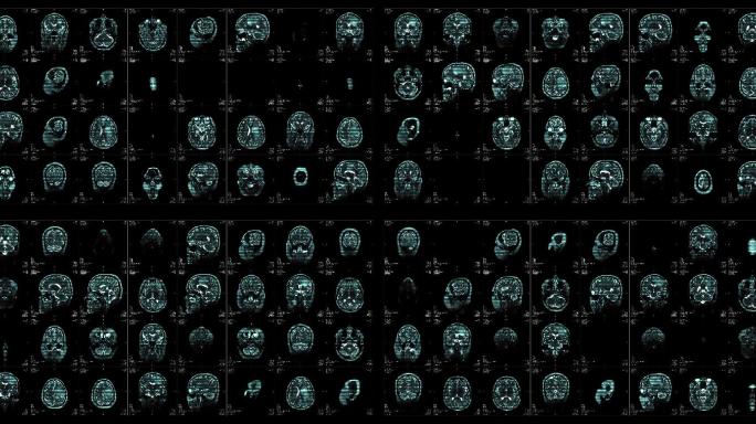 核磁共振成像视频墙。