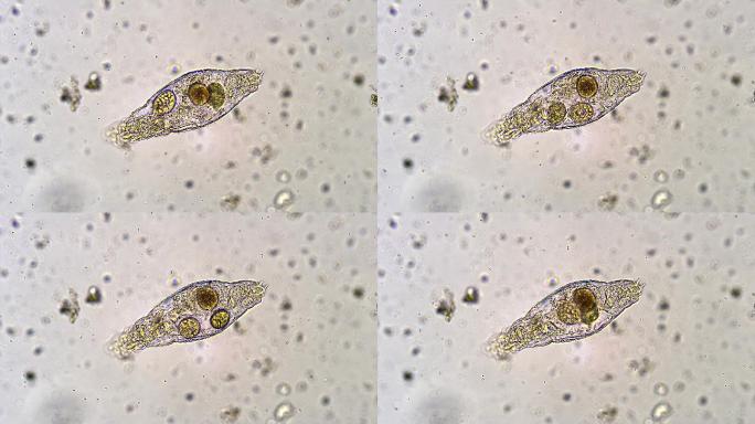 微生物纤毛虫